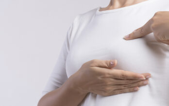 Woman performing a breast cancer self examination