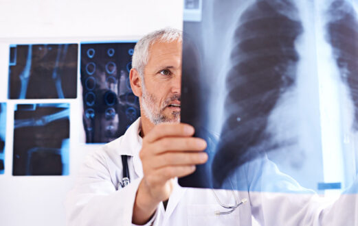 Doctor reviews and examines chest X-ray