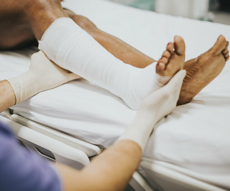 Ankle Fracture Surgery  Orthopedics Sports Medicine