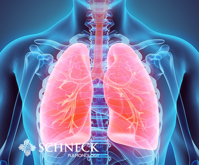 Lung | Schneck Medical Center