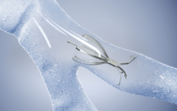 image of spiration valve