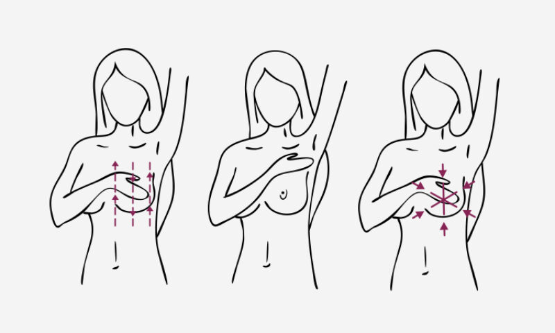 A breast self-examination is an inspection of your breasts that